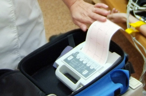 A medical professional holds an electrocardiogram (ECG) printout beside a patient with monitoring electrodes.