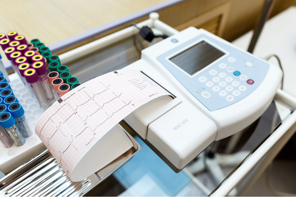 An electrocardiogram (ECG) machine printing a heart rate graph alongside vials of blood samples.